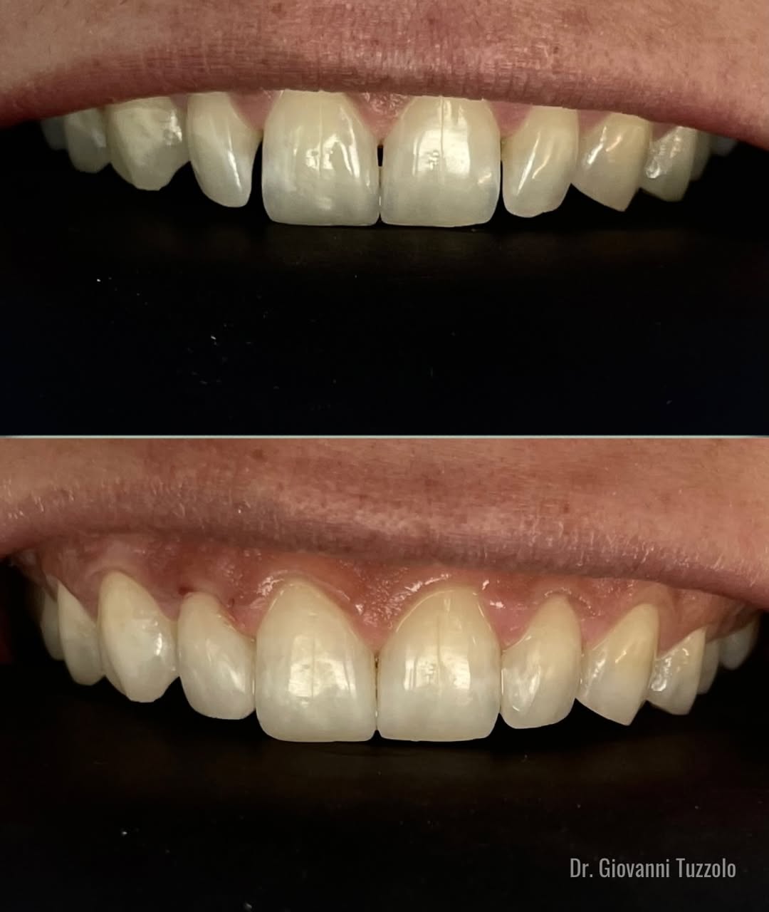 Transformação Estética — antes e depois